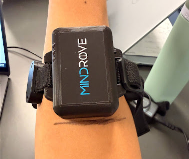 EMG Signal Acquisition